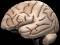 melt_brain
